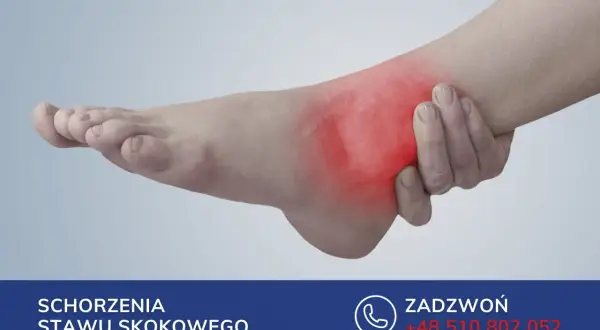 Stopa z zaznaczonym na czerwono bólem w okolicy stawu skokowego.