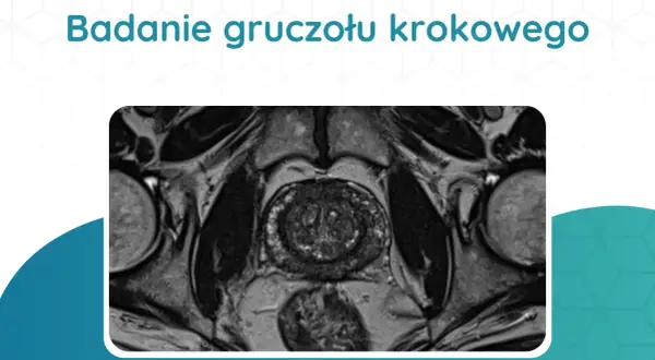 Tomografia prostaty: przekrój przez miednicę ukazujący gruczoł krokowy, pęcherz moczowy i inne struktury.