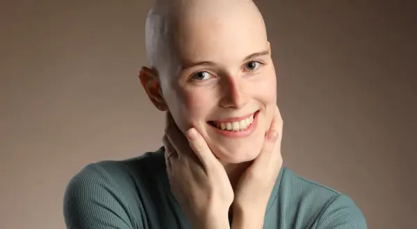 Lächelnde Frau mit Glatze, die ihre Wangen berührt. Ihre positiven Lymphom Chemotherapie Erfahrungen strahlen aus ihr.