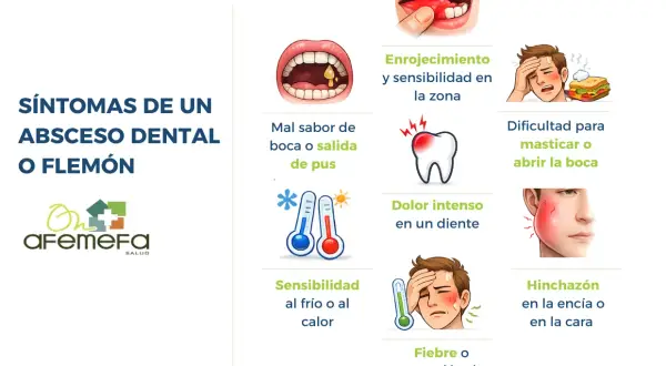 Síntomas de un absceso dental o flemón: enrojecimiento, mal sabor de boca, dolor intenso, sensibilidad al frío/calor, dificultad para masticar, fiebre e hinchazón.