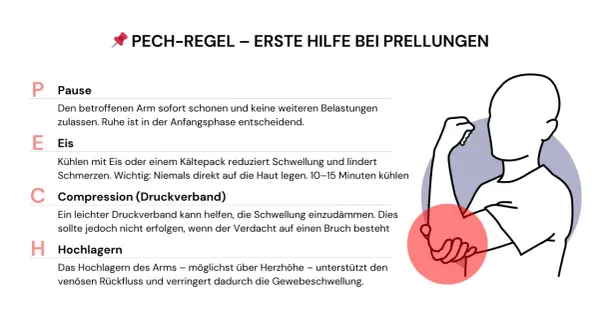 Erste Hilfe bei Prellungen: PECH-Regel erklärt. Bei einer Prellung am Unterarm sofort Pause machen, Eis kühlen, Compression anlegen und den Arm hochlagern.