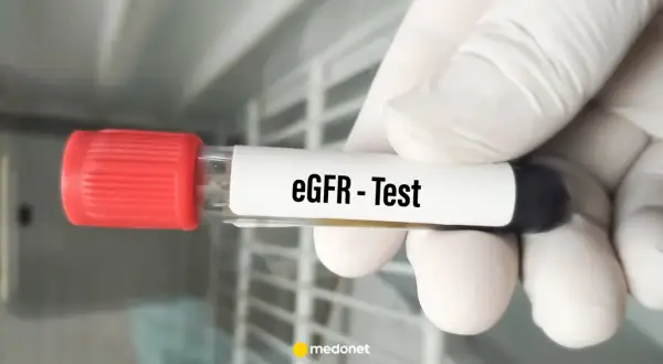 Rękawiczka trzyma probówkę z napisem "eGFR - Test". Wynik eGFR jest kluczowy dla oceny pracy nerek.