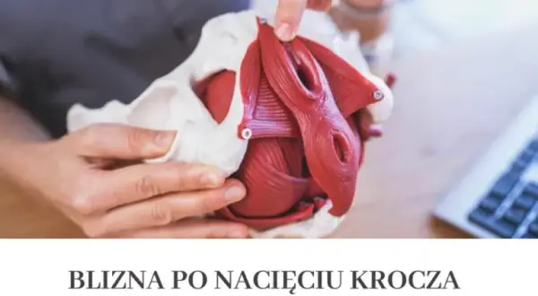 Jak dbać o krocze po porodzie: skuteczne sposoby na szybsze gojenie i komfort