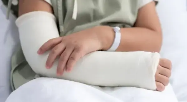 Złamanie łokcia ile gips – ile czasu musisz nosić gips?