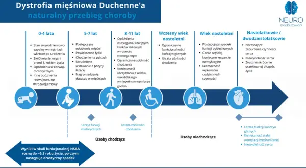Schemat postępu choroby Duchenne'a: od niemowlęctwa do dorosłości, ukazujący utratę funkcji motorycznych i oddechowych.