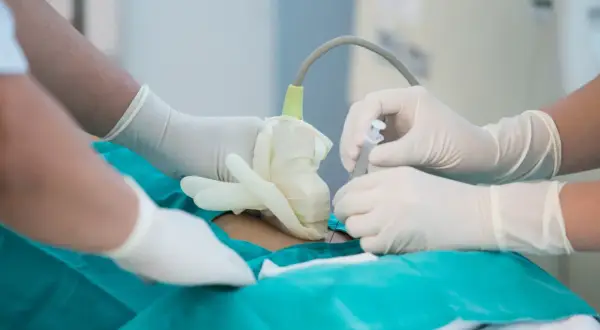 Lekarze w rękawiczkach wykonują amniopunkcję, pobierając płyn owodniowy do badań.