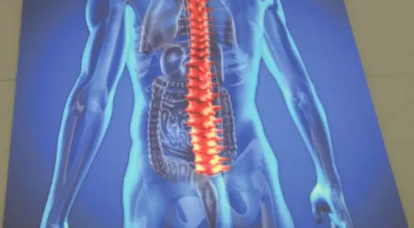 Anatomia człowieka z podświetconym czerwonym kręgosłupem, ilustracja medyczna ukazująca potencjalne problemy ze spondyloartropatią.