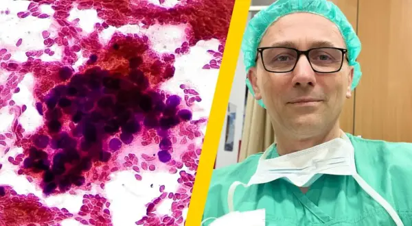 Mikroskopowy obraz komórek nowotworowych, które mogą być jednymi z najzłośliwszych nowotworów, obok lekarza w zielonym fartuchu i czepku.