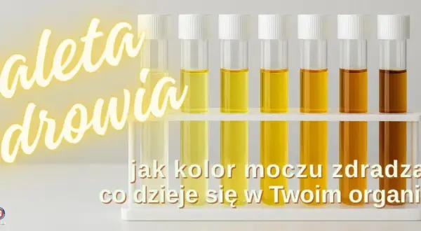 Paleta zdrowia: od jasnego do ciemnego moczu. Bardzo żółty mocz może sygnalizować zapalenie pęcherza.
