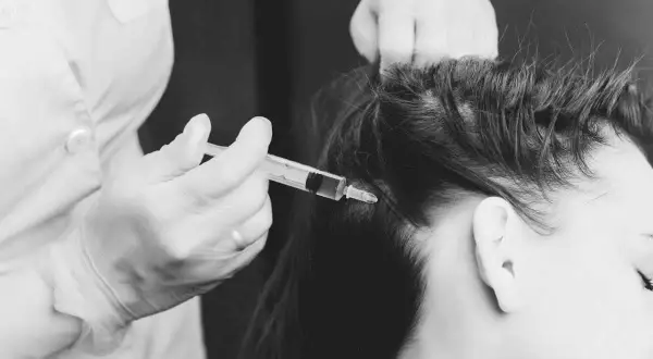 Zabieg peptydowa terapia włosów: specjalista w rękawiczkach wykonuje zastrzyk w skórę głowy pacjentki.