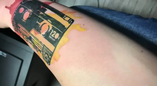 Ramię z tatuażem kasety magnetofonowej, widoczna opuchlizna po tatuazu i zaczerwienienie wokół.