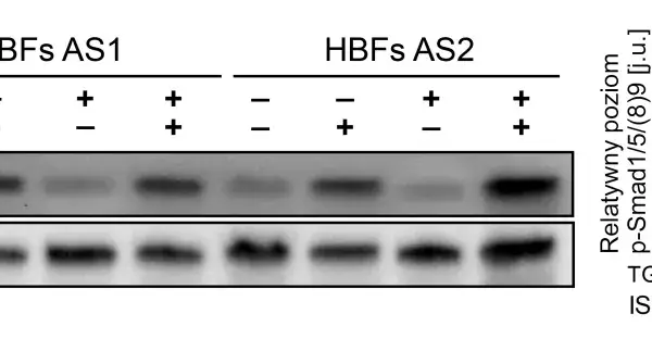 Western blot pokazujący poziom fosforylacji Smad1/5/9 w komórkach HBFs AS1 i AS2 po traktowaniu TGF-β₁ i ISL.