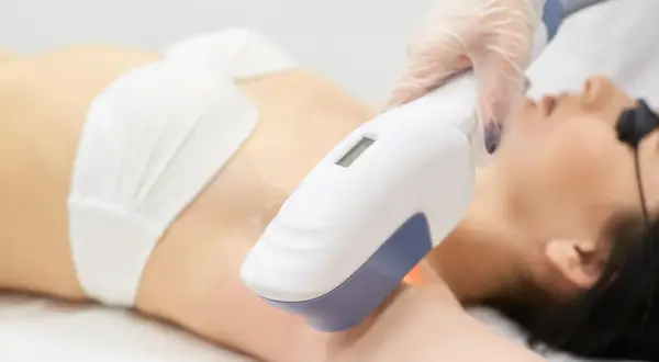 Depilacja laserowa bikini: co ile i ile zabiegów dla gładkiej skóry?