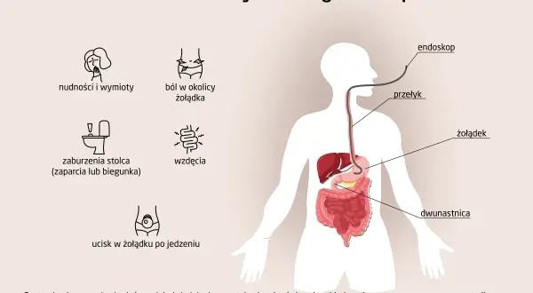 Objawy jak nudności, ból brzucha, wzdęcia, problemy z wypróżnianiem mogą sugerować potrzebę badania. Gastroskopia to metoda diagnostyczna co zamiast gastroskopii?