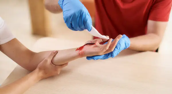 Person mit blauen Handschuhen legt Verband an blutende Wunde an der Hand an, um die Blutung zu stoppen.