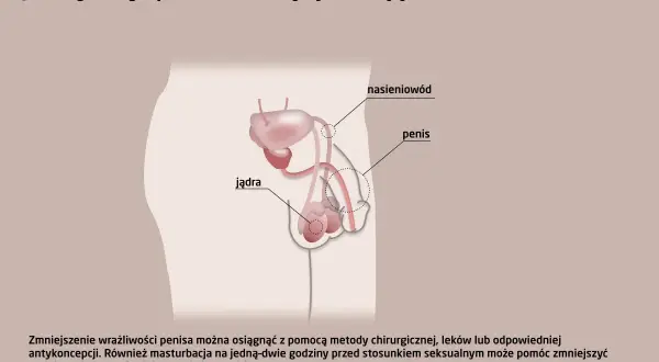Ilustracja układu rozrodczego męskiego z zaznaczonym penisem, jądrami i nasieniowodem. Tekst omawia metody leczenia przedwczesnej ejakulacji, np. zmniejszenie wrażliwości penisa, by nie dochodzić zbyt szybko.