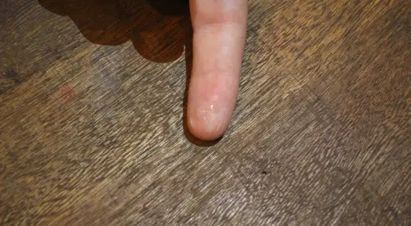 Doigt collé par de la glue. Voici comment enlever de la colle glue sur les doigts : tremper dans de l'eau savonneuse ou utiliser de l'huile.