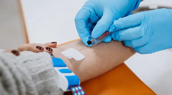 Cholesterol czy na czczo? Sprawdź, co mówią nowe wytyczne