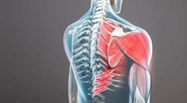 Vue anatomique du dos humain, mettant en évidence le muscle trapèze supérieur rouge vif et les muscles environnants.