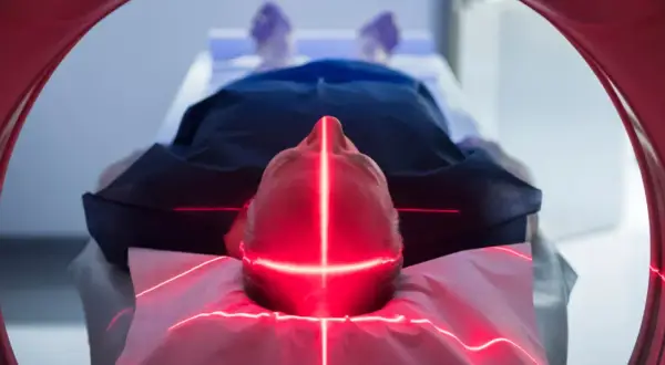 Mann liegt unter roten Laserlinien, die auf seinen Kopf zielen. Dies ist Teil einer neuen Krebstherapie.