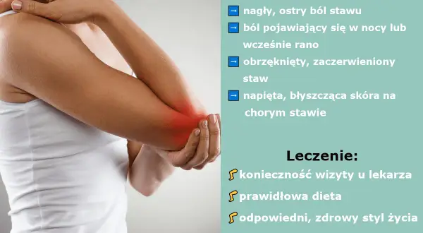 Dna moczanowa objawy: nagły ból stawu, obrzęk, zaczerwienienie. Leczenie: wizyta u lekarza, dieta, zdrowy styl życia.
