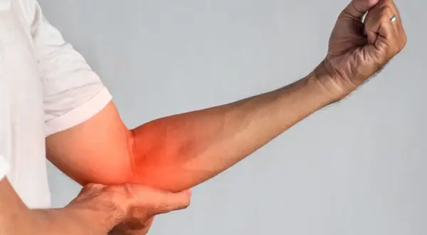 Braccio con tendinite evidenziata in rosso. Forse i rimedi della nonna possono aiutare.