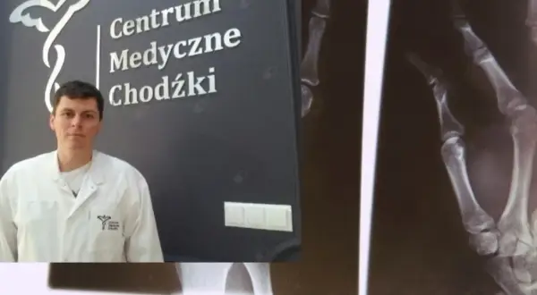 Lekarz w białym fartuchu na tle logo "Centrum Medyczne Chodźki" i zdjęcia RTG dłoni.