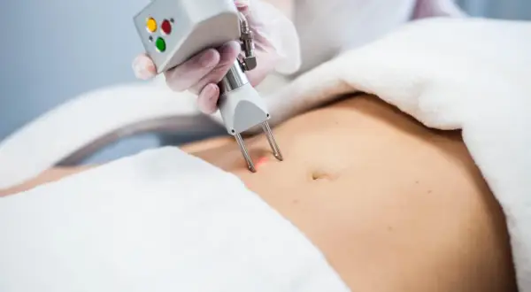 Zabieg liposukcji kawitacyjnej na brzuchu. Sprawdź, jaka jest liposukcja kawitacyjna cena i zacznij modelować sylwetkę.