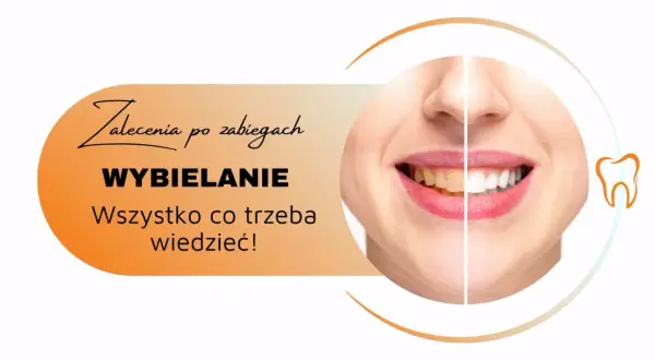 Zalecenia po zabiegach wybielania zębów. Uśmiech przed i po, by cieszyć się olśniewającą bielą.