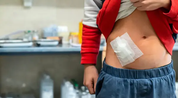 Dziecko z plastrem na brzuchu, odsłoniętym przez podwiniętą bluzę.