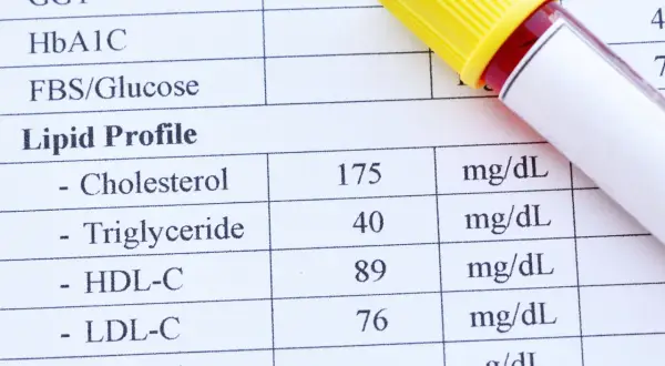 Wyniki lipidogramu: cholesterol, trójglicerydy, HDL-C, LDL-C. To badanie ocenia poziom tłuszczów we krwi.