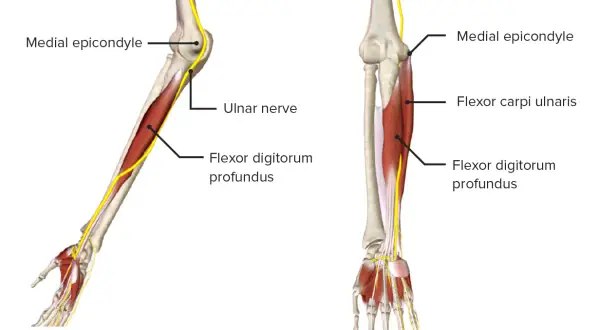 Anatomie des Arms: Nerven und Muskeln. Der Nervus ulnaris verläuft am medialen Epikondylus entlang und versorgt den Flexor digitorum profundus.