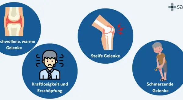 Illustrationen zeigen geschwollene, warme und steife Gelenke, Kraftlosigkeit und schmerzende Gelenke, typische Symptome von chronischer Polyarthritis.