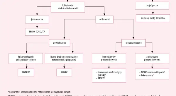 Schemat diagnostyczny torbieli/torbieli nerek. Rozróżnia się torbiele pojedyncze i mnogie, z objawami lub bez.