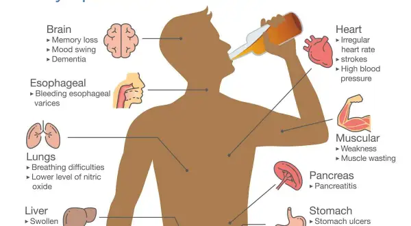 Ilustracja pokazuje objawy i skutki picia alkoholu, w tym nieodwracalne skutki dla mózgu, serca, płuc, wątroby, trzustki, żołądka i mięśni.