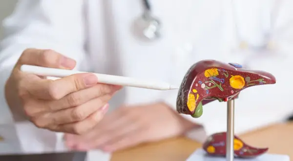 Lekarz wskazuje na model wątroby, omawiając chemioterapię na przerzuty do wątroby.