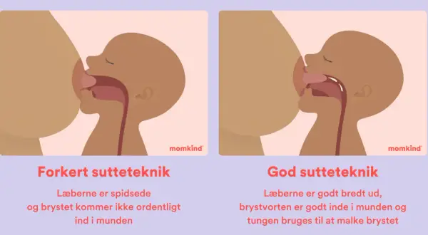 Illustrationer visar fel och rätt amningsteknik. Fel teknik: spetsade läppar, kort tungband kan hindra. Rätt teknik: breda läppar, bröstvårtan djupt inne, tungan mjölkar bröstet.