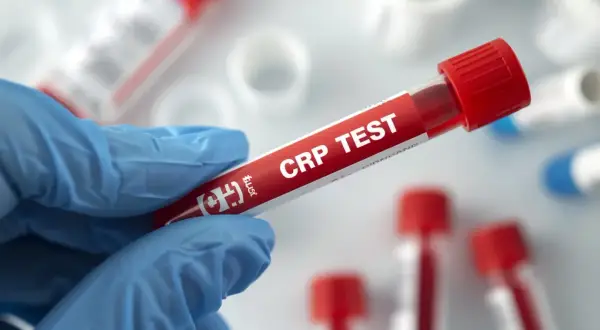 Ręka w niebieskiej rękawiczce trzyma probówkę z napisem "CRP TEST". To badanie pozwala ocenić poziom białka c-reaktywnego, wskaźnika stanu zapalnego.