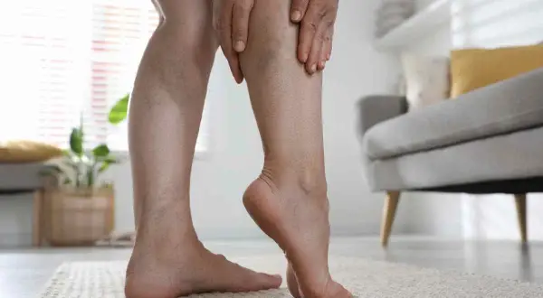 Gambe con vene varicose, che sembrano quasi bloccate, mentre una mano le sfiora con preoccupazione.