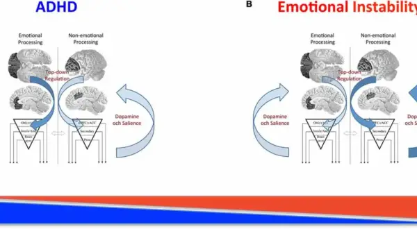 Diagram som visar hur dopamin och saliens påverkar emotionell och icke-emotionell bearbetning vid ADHD och emotionell instabilitet.
