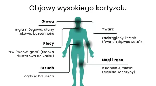 Wysoki kortyzol objawia się mgłą mózgową, otyłością brzuszną, "twarzą księżycowatą" i garbkiem tłuszczowym na karku.