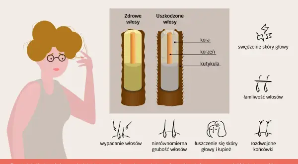 Ilustracja pokazuje porównanie zdrowych i uszkodzonych włosów, podkreślając problem łamliwości.