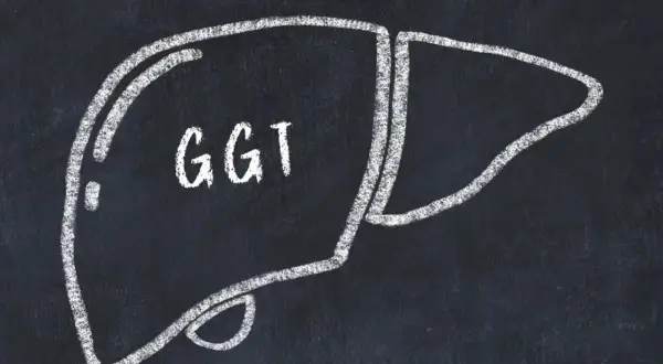 Szkic wątroby z napisem GGT. Wartość GGT norma jest kluczowa dla oceny stanu tego narządu.