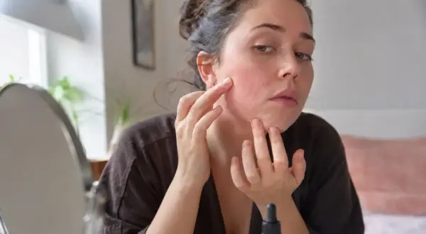 Kobieta bada zaczerwienioną skórę twarzy, sprawdzając możliwe retinol efekty uboczne.