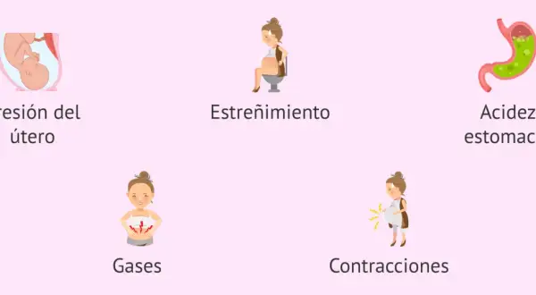 Ilustraciones de síntomas comunes del embarazo: presión uterina, estreñimiento, acidez, gases y contracciones. El dolor es parte de la experiencia.