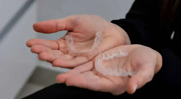 Mani che tengono bite trasparenti, utili per contrastare le mad apnee notturne.