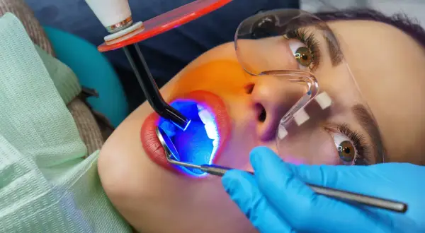 Zabieg lakowania zębów uśmiechniętej pacjentki. Dentysta używa lampy polimeryzacyjnej do utwardzenia materiału.