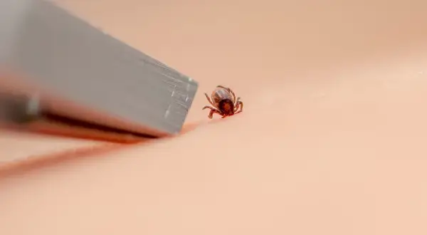 Jak wyjąć kleszcza? Szybka i bezpieczna instrukcja krok po kroku