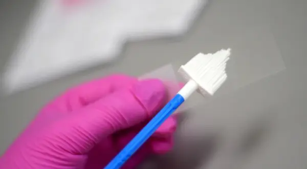Różowa rękawiczka trzyma szczoteczkę do pobierania wymazu. Przygotowanie do cytologii cienkowarstwowej.