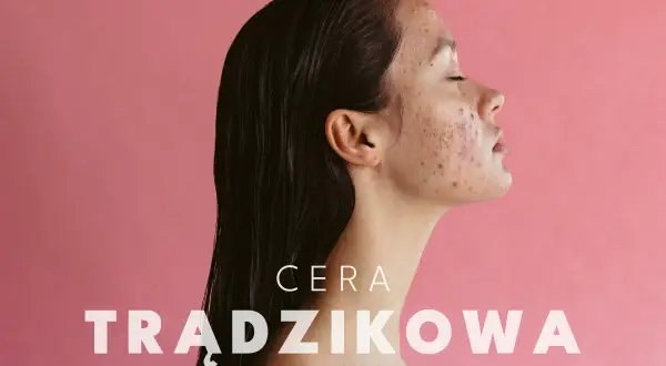 Jak dbać o cerę trądzikową? Skuteczna pielęgnacja krok po kroku